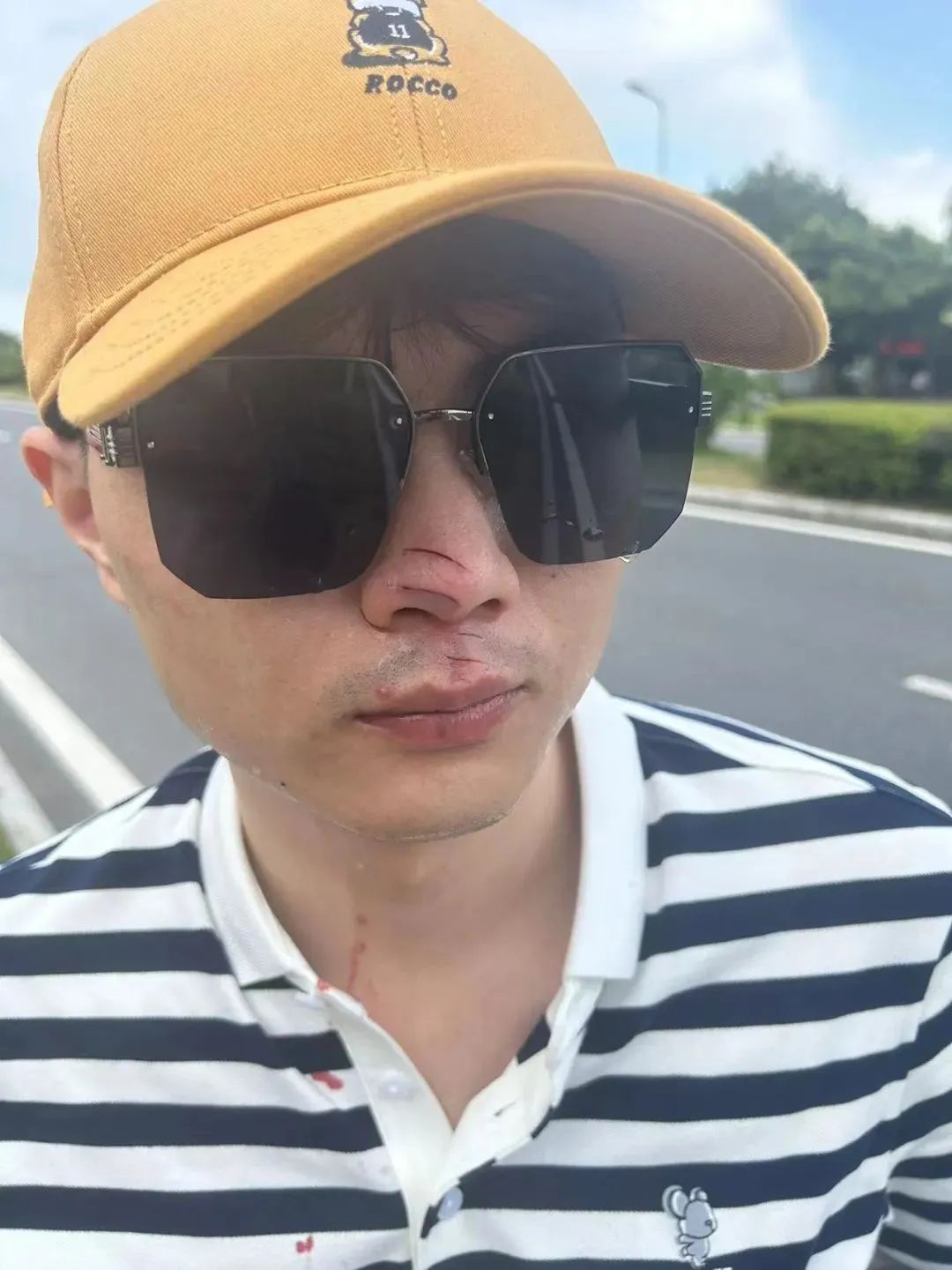 無人機傷人，飛手該擔何責？律師解讀
