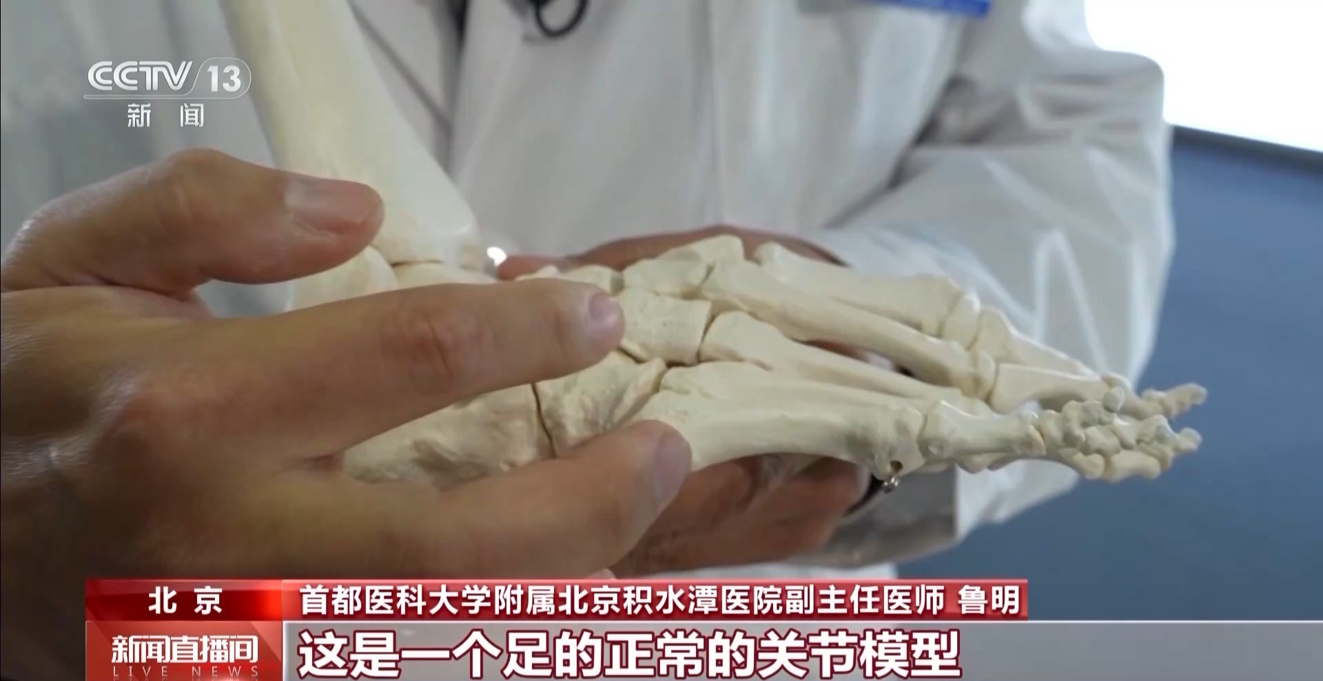 瘋狂種草碳板跑鞋？醫(yī)生：足底筋膜炎警告！