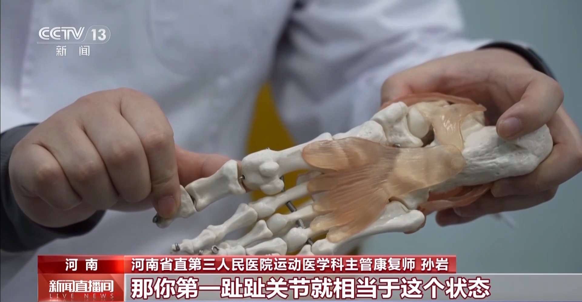 瘋狂種草碳板跑鞋？醫(yī)生：足底筋膜炎警告！