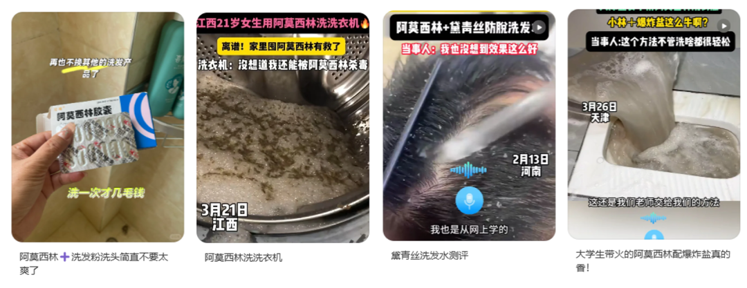 用阿莫西林洗頭，能治療脫發(fā)？別信！